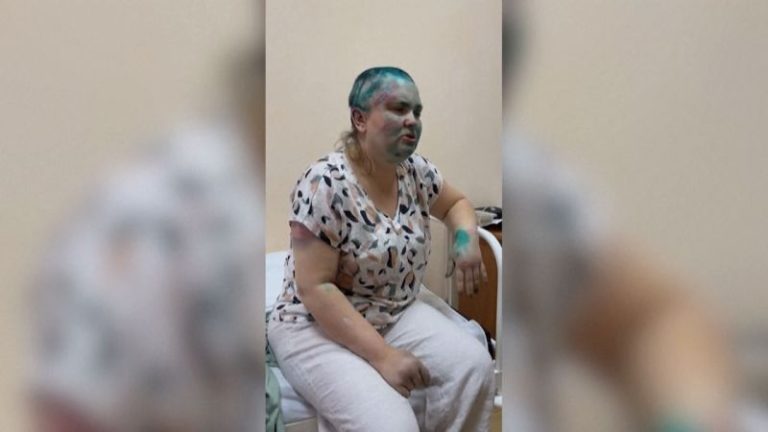 Prominent Russian journalist ‘severely beaten’ in attack in Chechnya