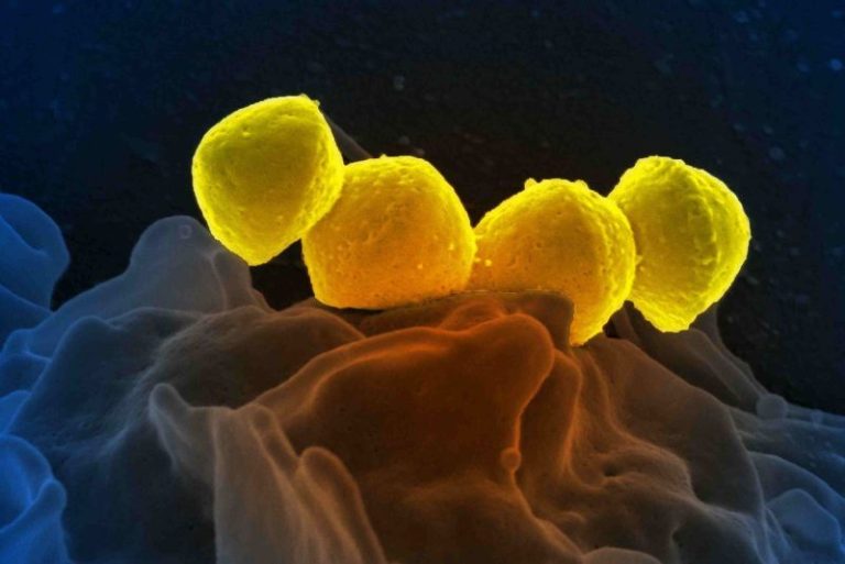 Japan reports record spike in potentially deadly bacterial infection